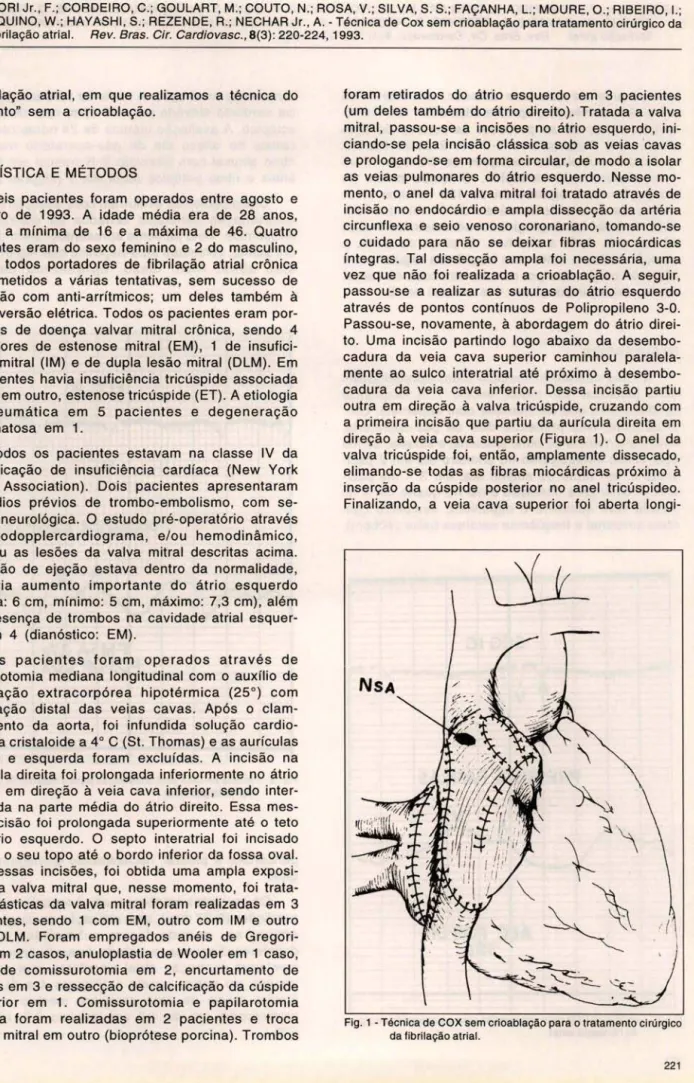 Fig . 1 - Técnica de COX sem crioablação para o tratamento cirúrgico  da fibrilação atrial