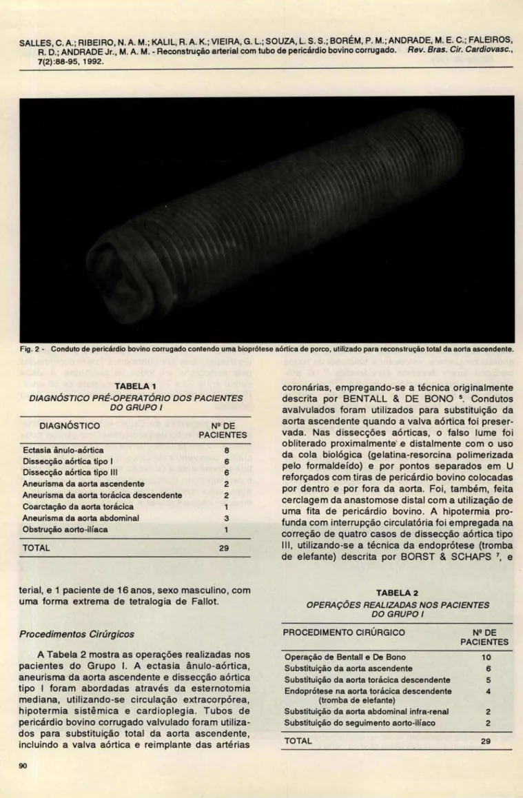 Fig . 2  - Conduto de pericárdio bovino corrugado contendo uma bioprótese aórtica de porco, utilizado para reconstruçáo total da aorta ascendente