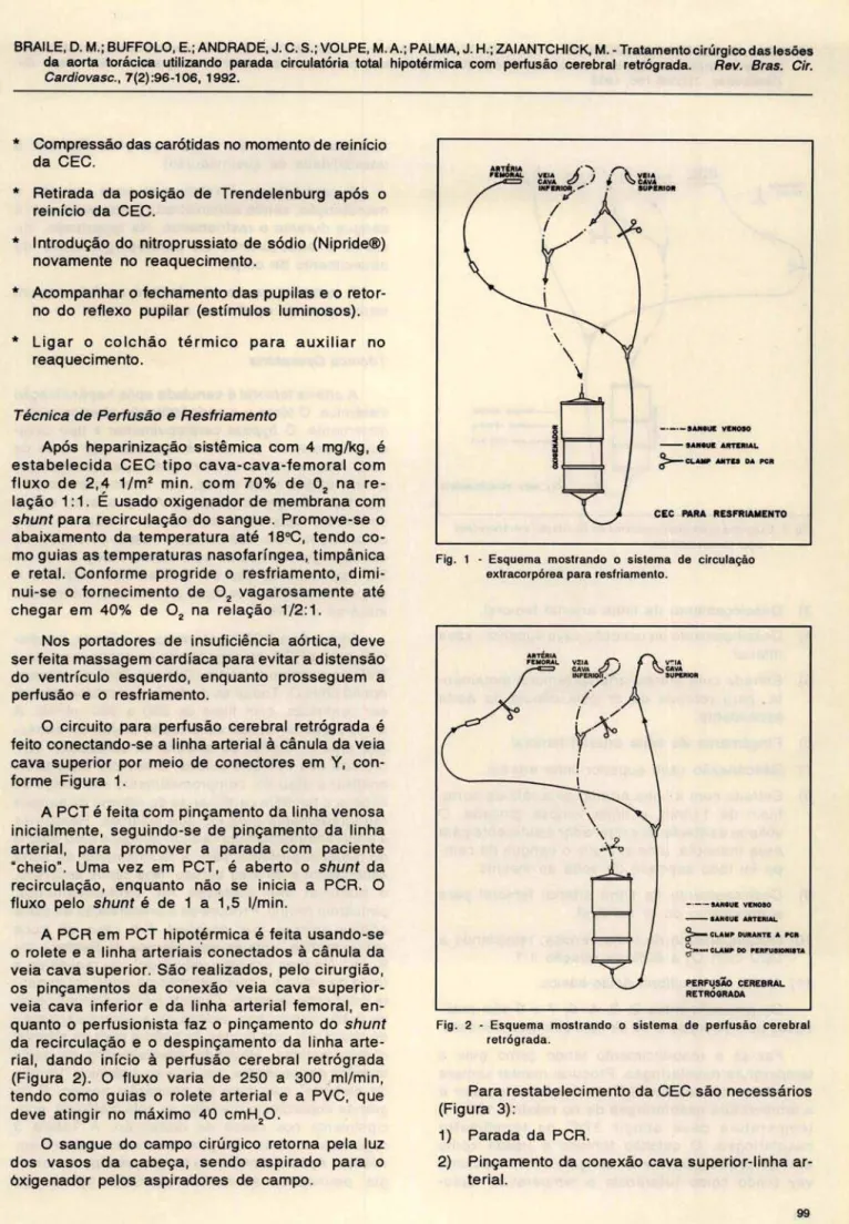 Fig .  1  - Esquema  mostrando  o  sistema  de  circulação  extracorpórea para resfriamento