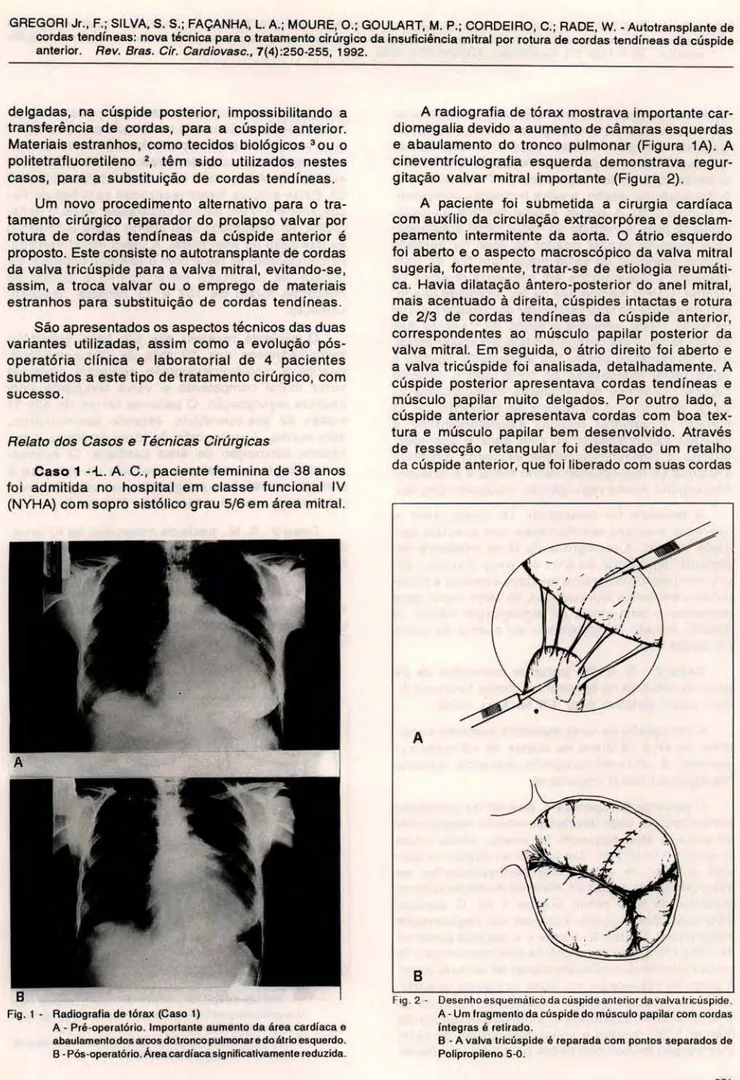 Fig.  1 - Radiografia de lórax (Caso  1) 