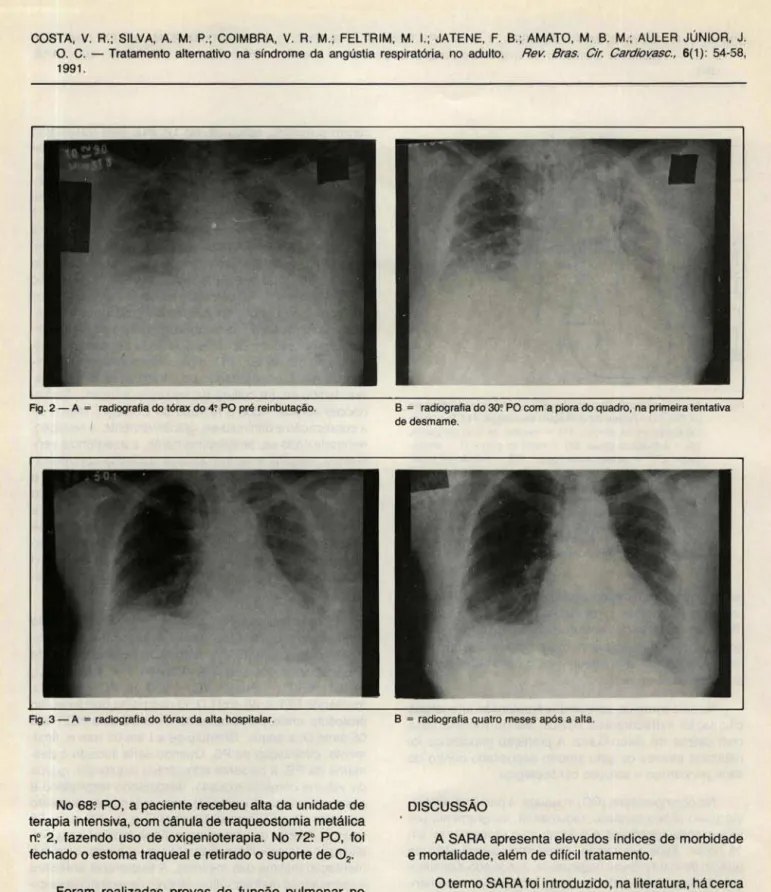Fig.  2 - A  =  radiografia do tórax do 4? PO pré reinbutação. 