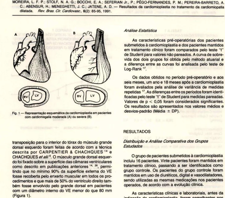 Fig . 1 - Representação esquemática da cardiomioplastia em pacientes  com cardiomegalia moderada (A)  ou  severa (B)
