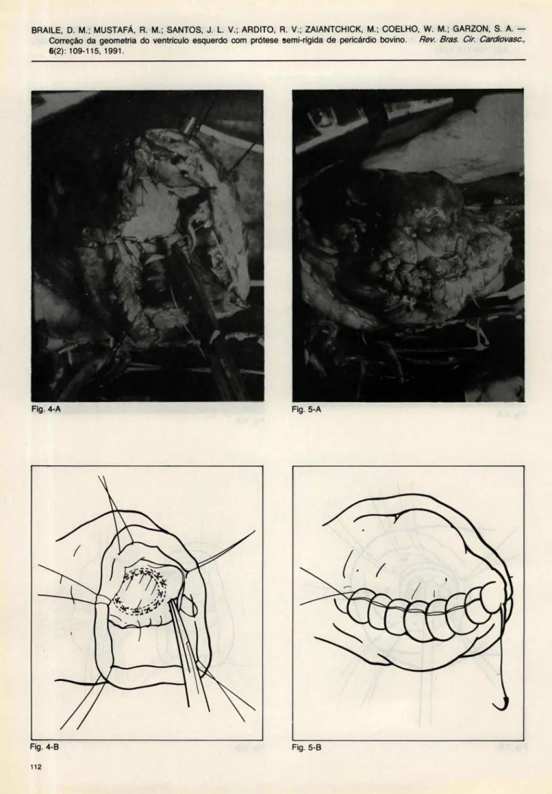 Fig. 4-A  Fig. 5-A 