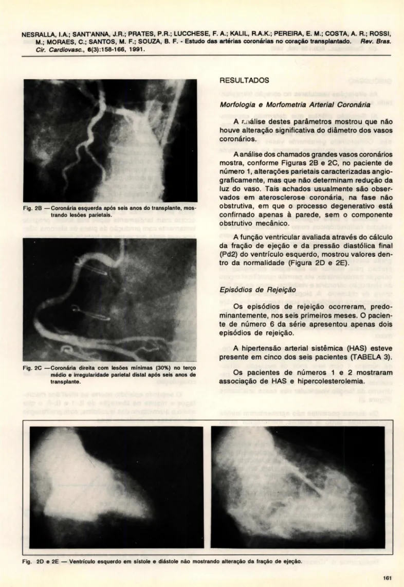 Fig.  28  - Coronária esquerda após  seis  anos do transplante.  mos- mos-trando  lesões  parietais 