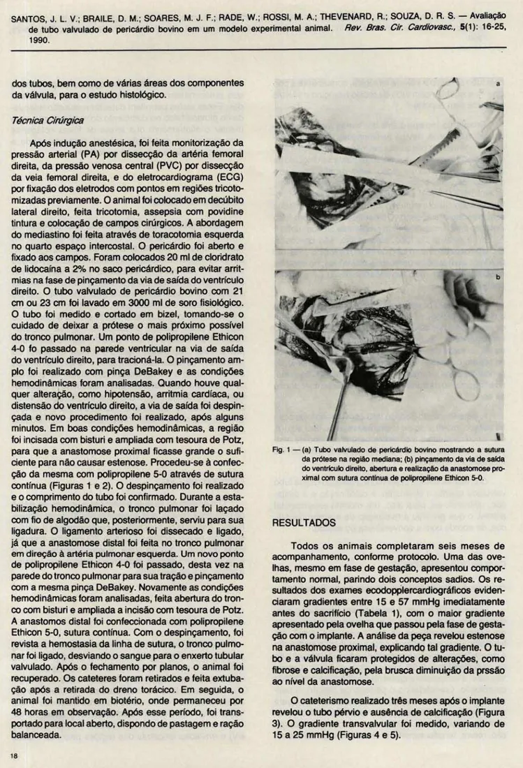 Fig. 1 - (a)  Tubo  valvulado  de pericárdio  bovino  moS1rando  a  su1Ura  da prótese na região mediana; (b)  plnçamento da via de sarda  do  ventriculo direito, abertura e realização da anastomose  pro-ximal com sutura contfnua  de  pollpropilene Ethicon