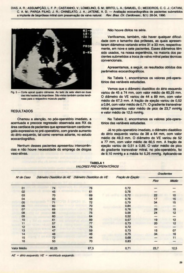 Fig.  5 - Corte  apical  quatro cAmaras.  Ao  lado  da  seta  vêem-se  duas  das três hastes da bioprÓtese