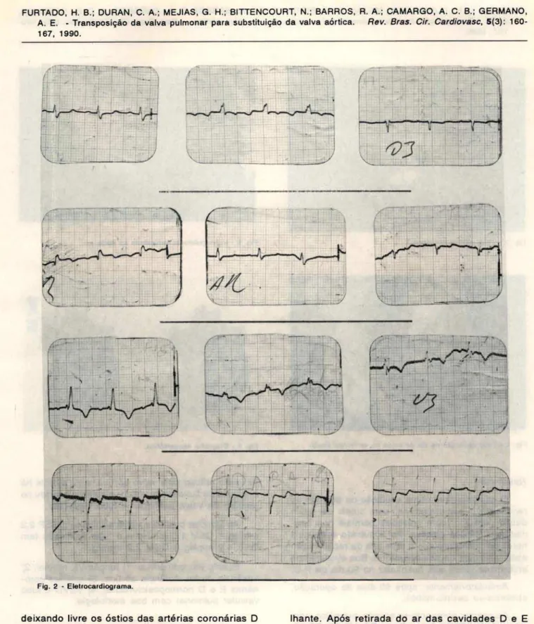 Fig .  2  - Eletrocardiograma. 