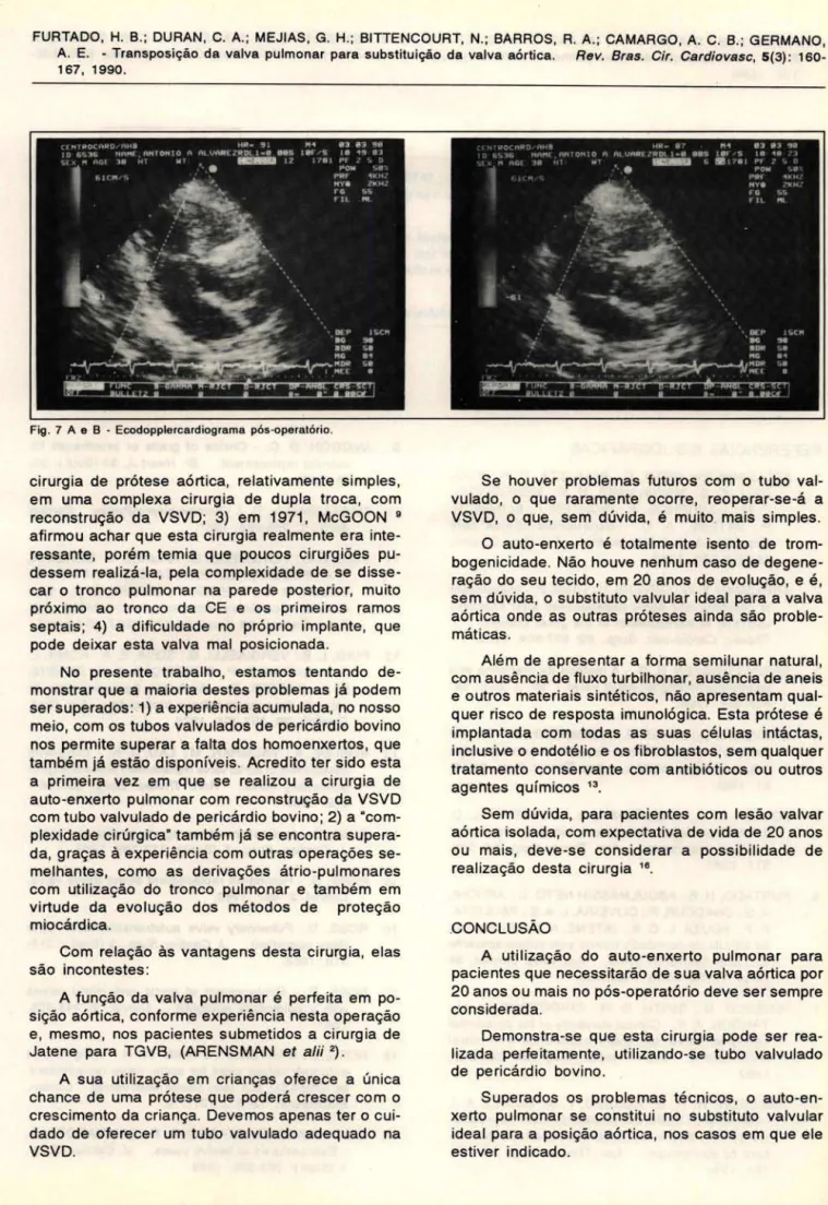 Fig .  7  A  e  B  - Ecodopplercardiograma  pós-operatório . 