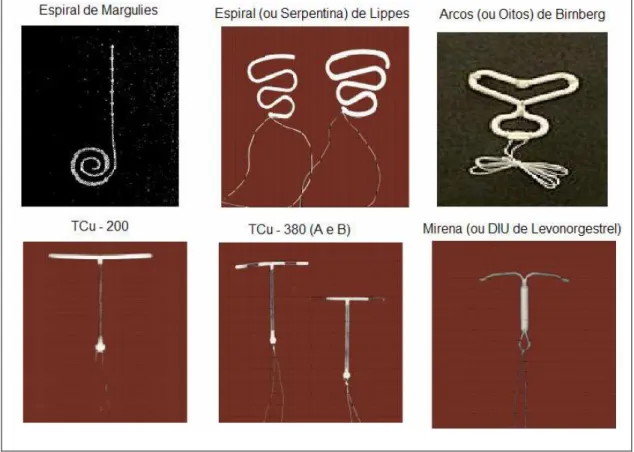 Figura 1 – Diferentes Tipos de DIU 