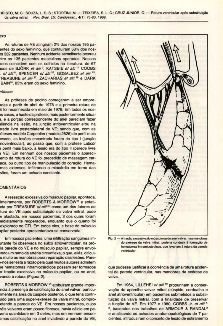Fig.  2 - A traçAo excessiva  do  músculO ou  do  anel valvar. nas manobras 