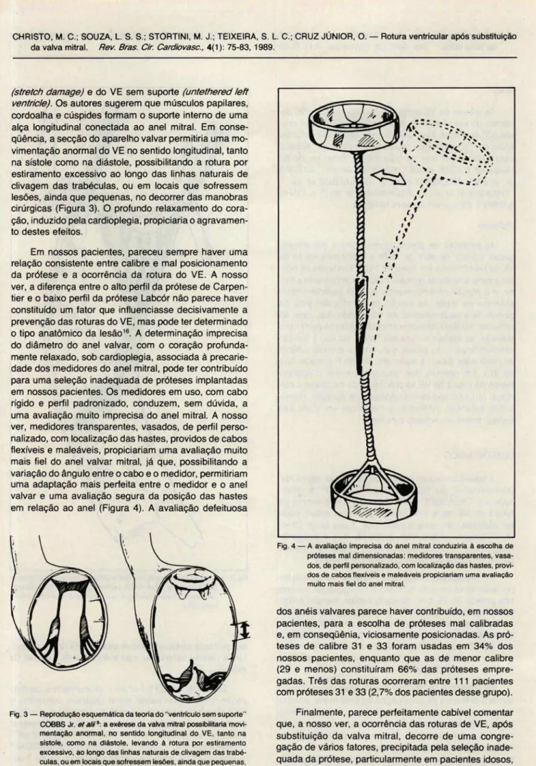 Fig.  3 - Reprodução esquemática da teoria do &#34;ventrículo sem suporte&#34; 