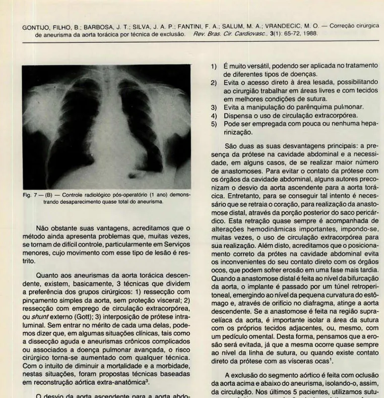 Fig .  7 - (8)  - Controle  radiológico  pós-operatório  (t  ano)  demons- demons-trando desaparecimento quase total do  aneurisma