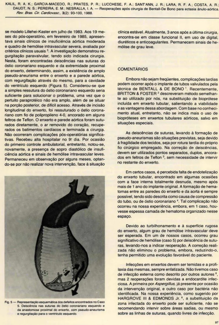 Fig . 5 - Representação esquemática doS defeitos encontrados no Caso 