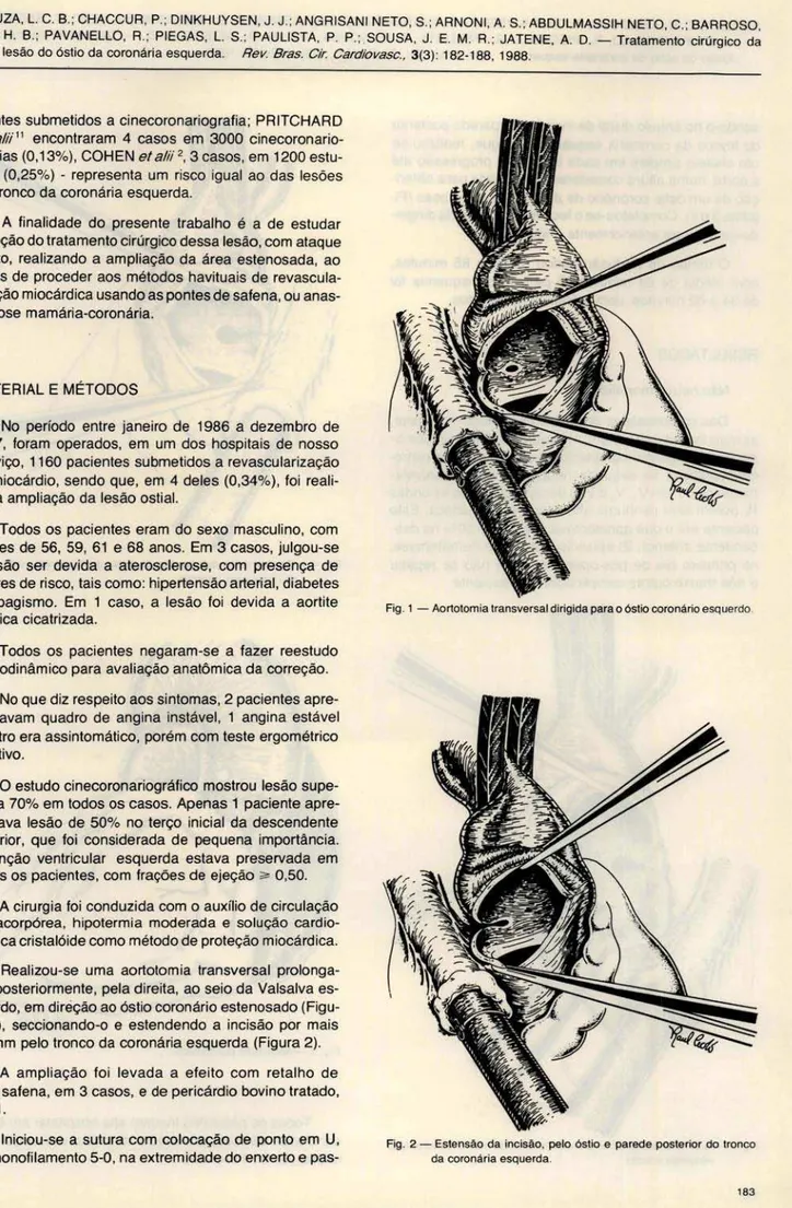 Fig . 2 - Estensão  da  incisão.  pelo  óstio  e  parede posterior  do tronco  da coronária esquerda 