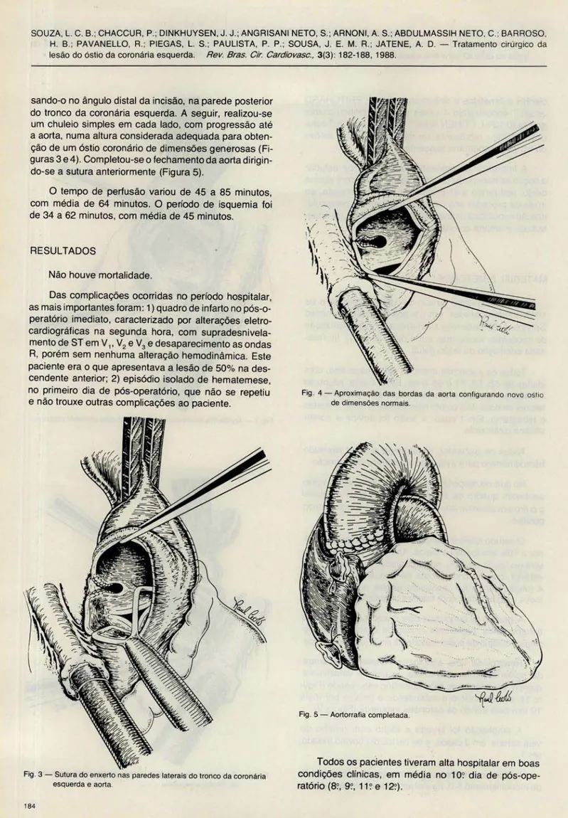 Fig . 3  - Sutura do en xerto nas  paredes laterais do tron co da coronária  esquerda e aorta 