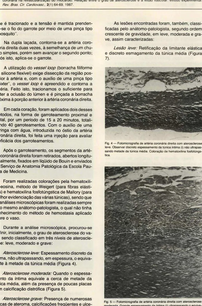 Fig . 4 - Fotomicrografia de  artéria coronária direita com  aterosclerose  leve . Observar discreto espessamento da túnica íntima (i) não  ultrapas-sando metade da túnica média