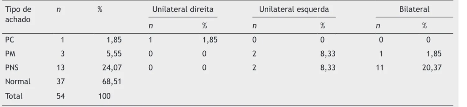 Tabela 3  Achados à audiometria tonal em pacientes com migrânea vestibular Tipo de 