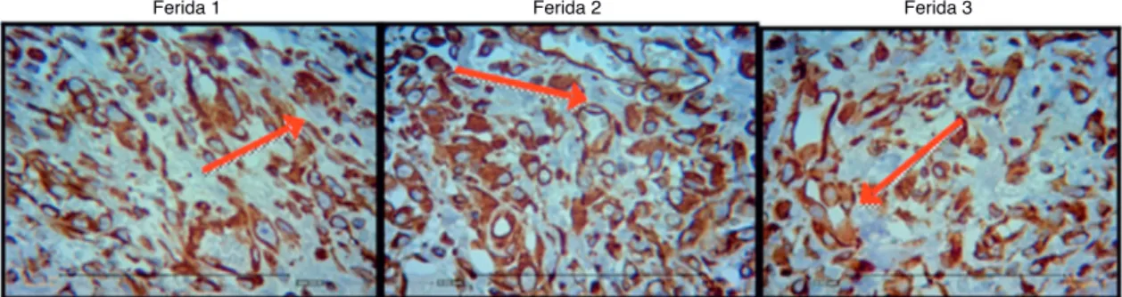 Figura 8  Fotomicrografia vimentina – nas quais são avaliados macrófagos, fibroblatos e vasos no terceiro dia de evolução, nas feri- feri-das 1, 2 e 3 (VIM 200×).