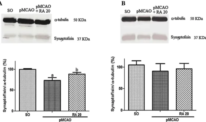 Fig. 10. Effect of rosmarinic acid (RA) 20 mg/kg on the expression of synaptophysin (A) in the striatum and (B) in the hipoccampus of mice submitted to pMCAO