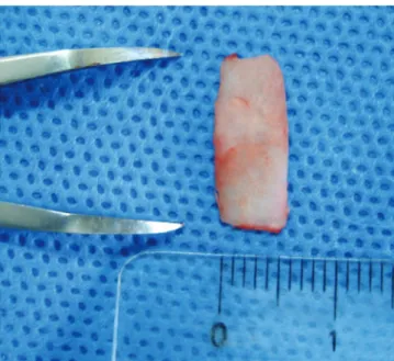 Figura 3  Confecção de uma tira de cartilagem de 0,5 cm de  largura medida com compasso cirúrgico sem Gelfoam ® .