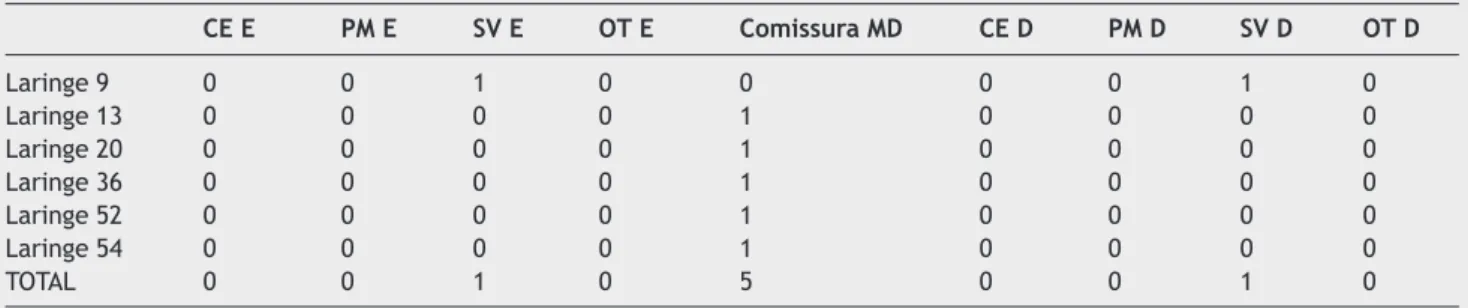 Figura 2   Depressão longitudinal, semelhante ao sulco vocal  (setas), observada ao microscópio cirúrgico, aumento de 40×