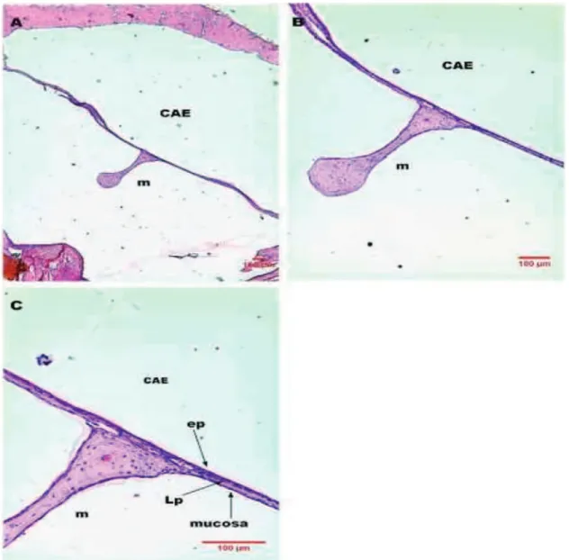 Figura 7  Imagens de corte histológico de MT de rato após 14 dias de perfuração traumática corado em HE