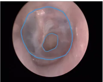 Figure  1   Imagem  obtida  através  da  circunscrição  da 