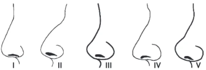 Figura 5   Perfis nasais em homens jovens turcos.