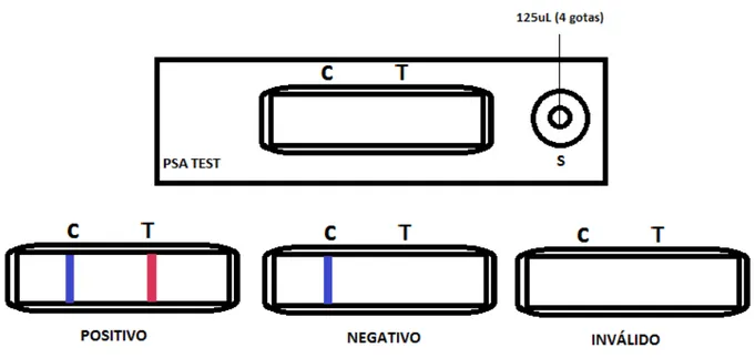 Figura 4 - Esquema ilustrativo da realização do teste de PSA. 