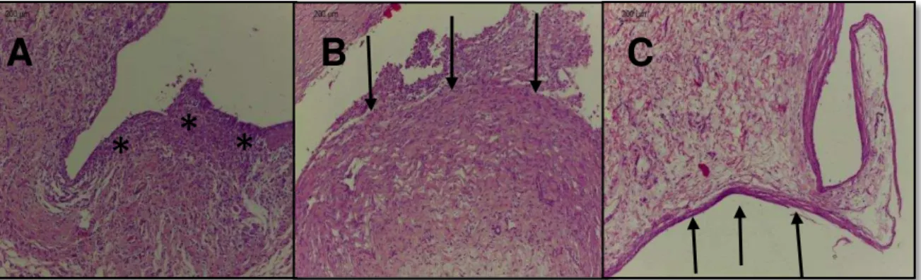 Figura  8:  Fotomicrografias  das  amostras  do  Grupo  M18  A)  7  dias  após  implantação:  área  de  inflamação  adjacente  à  cavidade  (HE,  100X    aumento,  escala:  200µm)