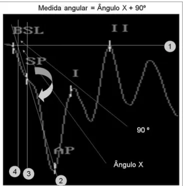 Figura 2.  Roteiro para obtenção do método gráfico para mensuração  do ângulo: