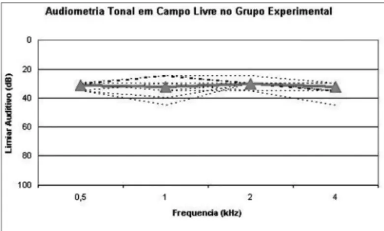 Figura 1.  Audiometria Tonal em Campo Livre - Resultados dos limiares  auditivos em campo livre (dB) nas freqüências de 0,5, 1, 2 e 4 kHz