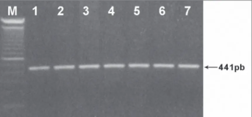 Figura 1.  Fragmento de 441pb do gene 12S rRNA amplificado por  PCR e analisado em gel de agarose 1%