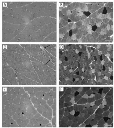 Figura  1.  Fotomicrografia do músculo EDL. HE (A, C, E); mATPase  pH 4,6 (B, D, F). 