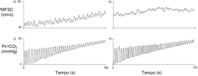 Figura  05  -  Exemplos  dos  dados  brutos  de  velocidade  média  do  fluxo  sanguíneo  cerebral  (MCFV)  e  pressão  parcial  de  CO 2   na  mistura  gasosa  expirada  (P ET CO 2 )  obtidos  em  um  indivíduo  não  tabagista  controle  (a  e  c)  e  um 