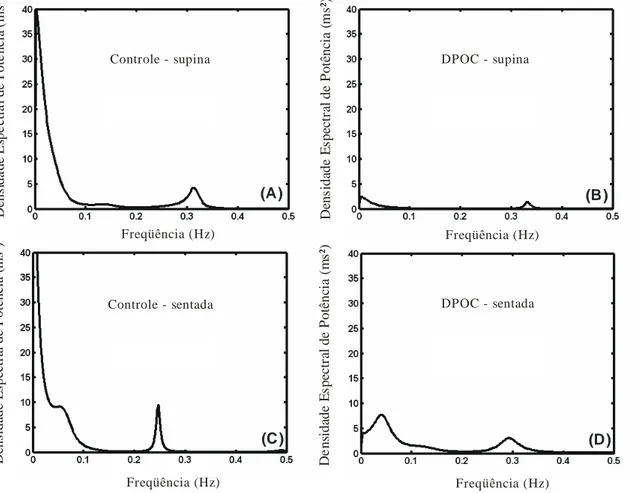 Figura 1. Representação gráfica da densidade espectral de potência de um indivíduo do grupo controle (A e C) e de um indivíduo do grupo de