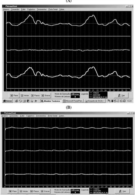 Figura 1. Exemplo ilustrativo da tela do computador antes (A) e após (B) a realização da terapia com biofeedback associado ao padrão quiet breathing em respirador bucal funcional