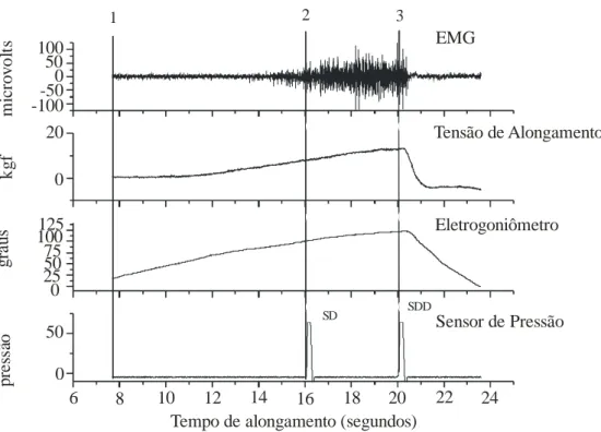 Figura 2. Exemplo de sinal coletado durante o teste de alongamento dos músculos isquiotibiais para avaliação das posições de sensação de desconforto