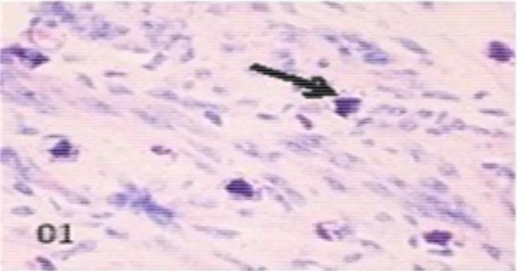 Figure 1. Mast cell stained by toluidine. 