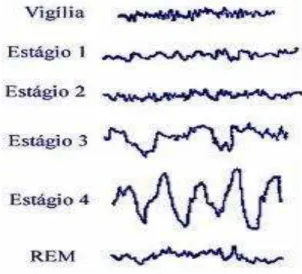 Figura 1. EEG do sono nas fases NREM e REM em um adulto jovem 