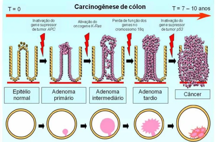 Figura 1 – Representação esquemática do desenvolvimento de câncer colorretal 