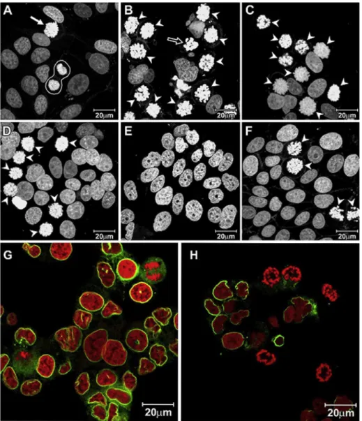 Fig. 1. Laser scanning confocal microscopy images of MCF-7 showing nuclei stained by propidium iodide: (A)control cells showing a normal metaphase (arrow) and telophase (surrounded by white line); (B) cells treated with 8 m M 1 for 24 h; (C) 90 m M 2 for 2