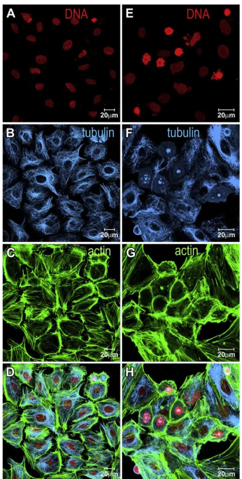 Fig. 2. Laser scanning confocal microscopy images depicting MCF-7 cells. Panels (A, B, C, D) indicate control cells and panels (E, F, G, H) indicate cells treated with 8 m M 1 for 24 h.