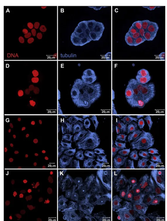 Fig. 3. Laser scanning confocal microscopy images showing T47D control cells (AeC) and T47D cells treated with 8 m M 1 for 24 h(DeF)