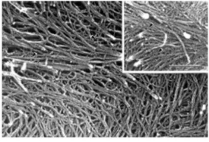 Figura 1 – Micrografia eletrônica de paredes celulares epidérmicas de ervilha (Pisum sativum)