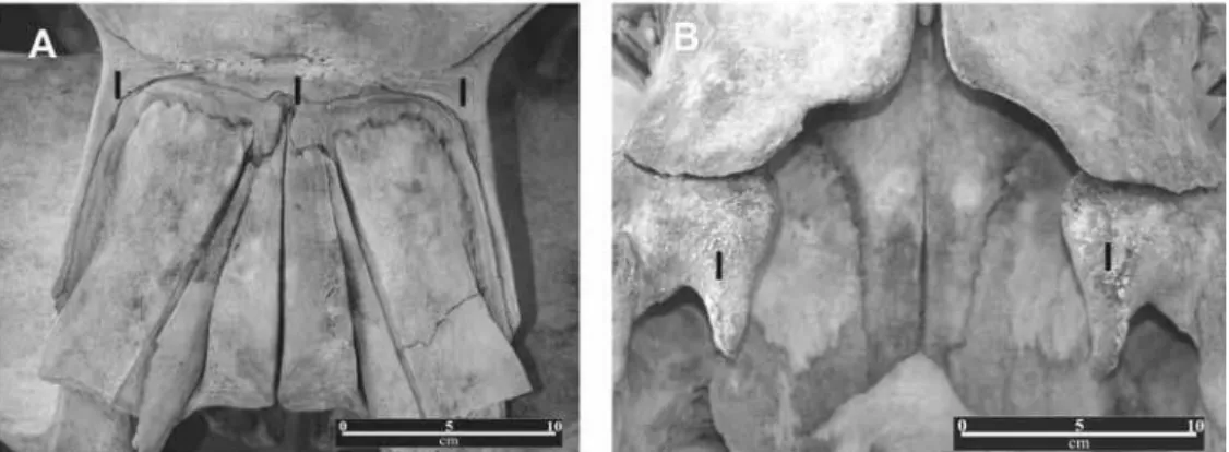 Figure 2 - The skull of the studied whale (REMANE#02C0150/265). (A) dorsal view, showing vertex  and the characters that distinguish the two species of minke whales from the Southern Hemisphere (I =  Interparietal, P = Parietal) (scale = 10cm); (B) ventral