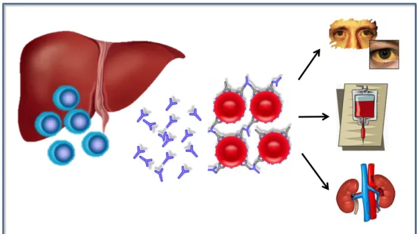 Figura 2: Representação da ocorrência e das complicações da SLP no pós-transplante  hepático