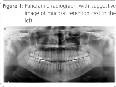 Figure 1:  Panoramic radiograph with suggestive  image of mucosal retention cyst in the  left.