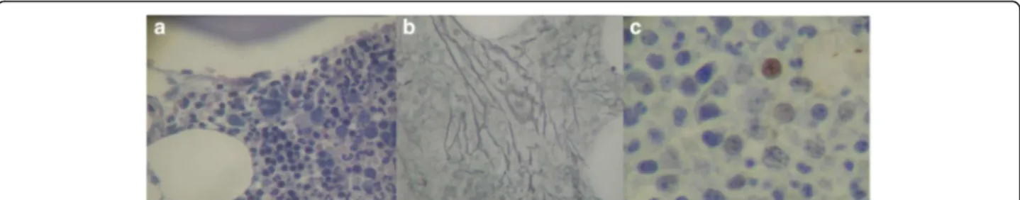 Fig. 2 a Myelogram of patient 2. a Hypercellularity; b mild focal thickening with reticulin staining; c p53 expression by immunohistochemistry at 2%