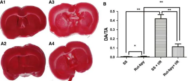 Fig. 1 A Representative TTC-stained-coronal brain sections from SS (A1), Rut-bpy (A2), SS?I/R (A3), and Rut-bpy?I/R (A4)